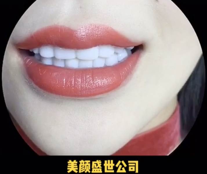 美牙效果對(duì)比一