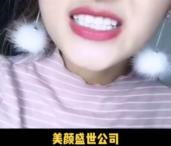 美牙效果對(duì)比三